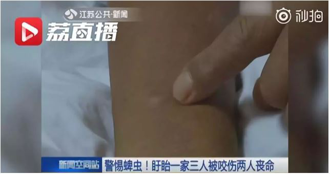 中山市民注意蜱蟲叮咬!請做好這些預(yù)防措施